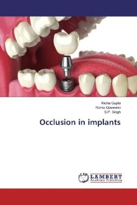 Gupta / Goswami / Singh |  Occlusion in implants | Buch |  Sack Fachmedien