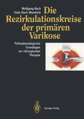 Hach-Wunderle / Hach |  Die Rezirkulationskreise der primären Varikose | Buch |  Sack Fachmedien