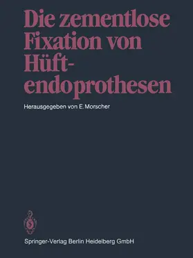 Morscher |  Die zementlose Fixation von Hüftendoprothesen | Buch |  Sack Fachmedien