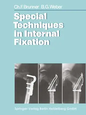 Brunner / Weber |  Special Techniques in Internal Fixation | eBook | Sack Fachmedien