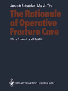 Schatzker / Tile |  The Rationale of Operative Fracture Care | eBook | Sack Fachmedien