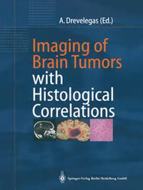 Drevelegas |  Imaging of Brain Tumors with Histological Correlations | eBook | Sack Fachmedien