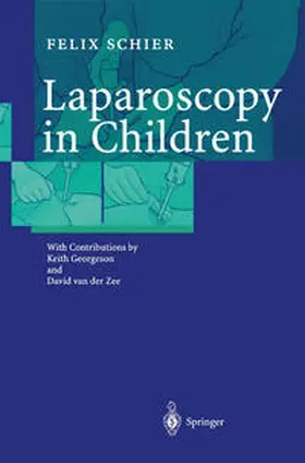 Schier |  Laparoscopy in Children | eBook | Sack Fachmedien