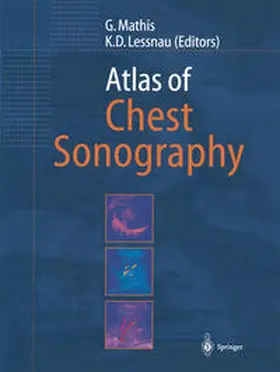 Mathis / Lessnau |  Atlas of Chest Sonography | eBook | Sack Fachmedien