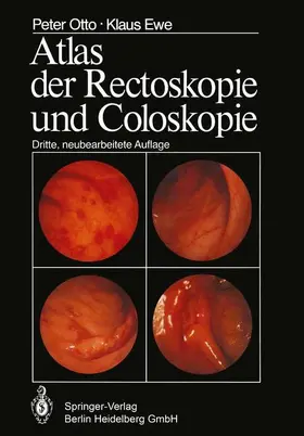 Ewe / Otto |  Atlas der Rectoskopie und Coloskopie | Buch |  Sack Fachmedien