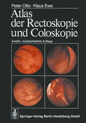 Otto / Ewe |  Atlas der Rectoskopie und Coloskopie | eBook | Sack Fachmedien