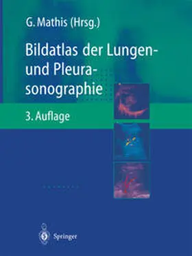 Mathis |  Bildatlas der Lungen- und Pleurasonographie | eBook | Sack Fachmedien