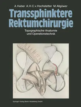 Huber / Hochstetter / Allgöwer |  Transsphinktere Rektumchirurgie | eBook | Sack Fachmedien