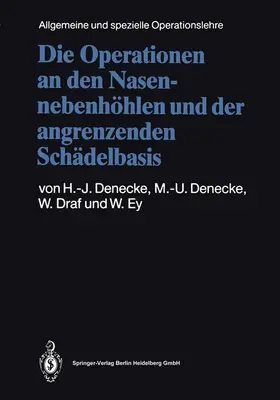 Denecke / Ey / Draf |  Die Operationen an den Nasennebenhöhlen und der angrenzenden Schädelbasis | Buch |  Sack Fachmedien