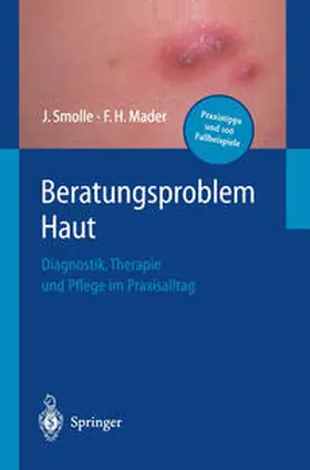 Smolle / Mader |  Beratungsproblem Haut | eBook | Sack Fachmedien