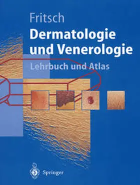 Fritsch |  Dermatologie und Venerologie | eBook | Sack Fachmedien