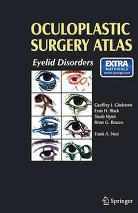 Nesi / Gladstone / Black |  Oculoplastic Surgery Atlas | eBook | Sack Fachmedien
