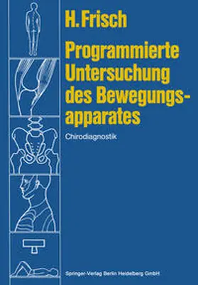 Frisch |  Programmierte Untersuchung des Bewegungsapparates | eBook | Sack Fachmedien