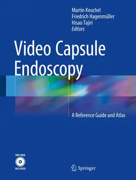 Keuchel / Hagenmüller / Tajiri |  Video Capsule Endoscopy | Buch |  Sack Fachmedien