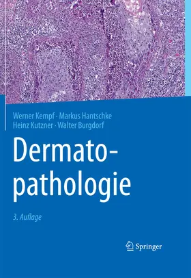 Kempf / Hantschke / Kutzner |  Dermatopathologie | eBook | Sack Fachmedien