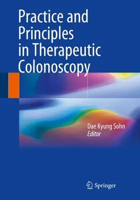 Sohn |  Practice and Principles in Therapeutic Colonoscopy | Buch |  Sack Fachmedien