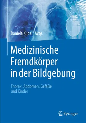 Kildal |  Medizinische Fremdkörper in der Bildgebung | Buch |  Sack Fachmedien