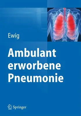 Ewig |  Ambulant erworbene Pneumonie | Buch |  Sack Fachmedien