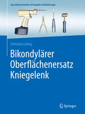 Lüring |  Bikondylärer Oberflächenersatz Kniegelenk | eBook | Sack Fachmedien