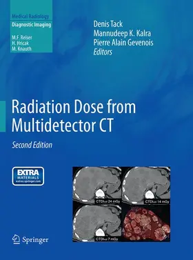 Tack / Gevenois / Kalra | Radiation Dose from Multidetector CT | Buch | 978-3-662-50039-2 | sack.de