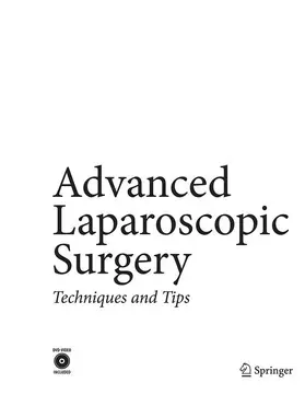 Katkhouda |  Advanced Laparoscopic Surgery | Buch |  Sack Fachmedien