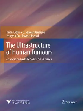 Eyden / Liberski / Banerjee |  The Ultrastructure of Human Tumours | Buch |  Sack Fachmedien