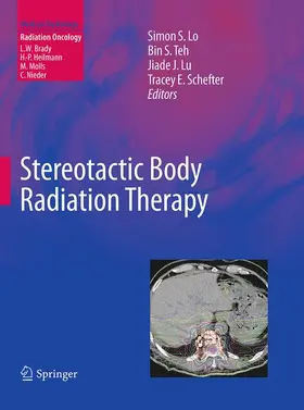 Lo / Schefter / Teh |  Stereotactic Body Radiation Therapy | Buch |  Sack Fachmedien