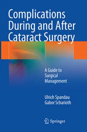 Scharioth / Spandau |  Complications During and After Cataract Surgery | Buch |  Sack Fachmedien