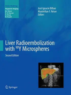 Reiser / Bilbao |  Liver Radioembolization with 90Y Microspheres | Buch |  Sack Fachmedien