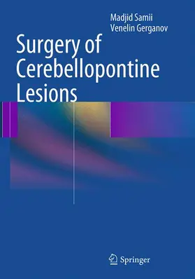 Gerganov / Samii |  Surgery of Cerebellopontine Lesions | Buch |  Sack Fachmedien