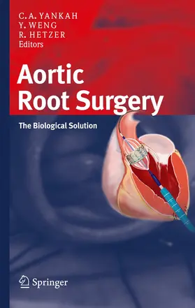 Yankah / Weng / Hetzer |  Aortic Root Surgery | Buch |  Sack Fachmedien