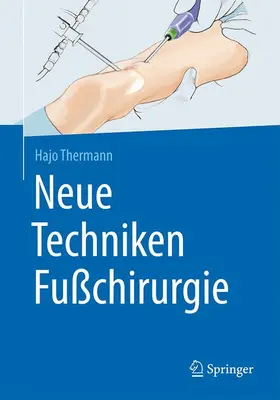 Thermann |  Neue Techniken Fußchirurgie | Buch |  Sack Fachmedien