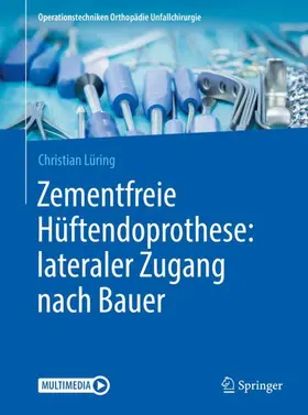 Lüring |  Zementfreie Hüftendoprothese: lateraler Zugang nach Bauer | Buch |  Sack Fachmedien