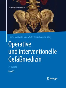 Debus / Gross-Fengels |  Operative und interventionelle Gefäßmedizin | Buch |  Sack Fachmedien