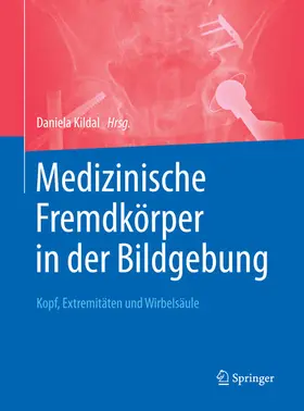 Kildal | Medizinische Fremdkörper in der Bildgebung | E-Book | sack.de