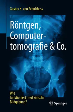 Schulthess | Röntgen, Computertomografie & Co. | E-Book | www2.sack.de