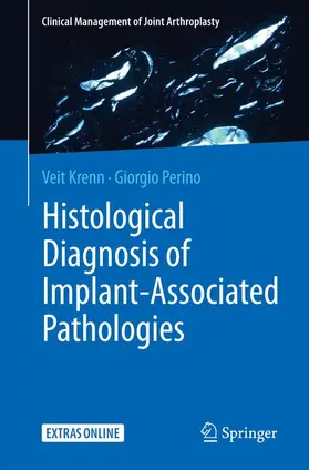 Krenn / Perino |  Histological Diagnosis of Implant-associated Pathologies | Buch |  Sack Fachmedien