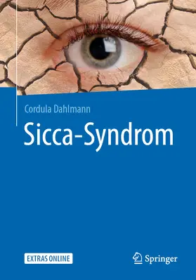 Dahlmann |  Sicca-Syndrom | eBook | Sack Fachmedien