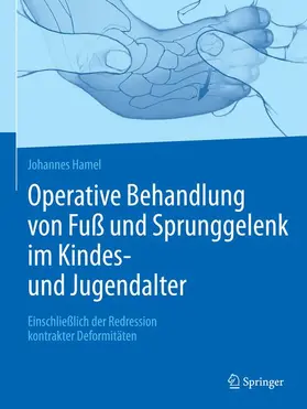 Hamel |  Operative Behandlung von Fuß und Sprunggelenk im Kindes- und Jugendalter | Buch |  Sack Fachmedien