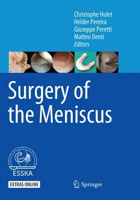 Hulet / Denti / Pereira |  Surgery of the Meniscus | Buch |  Sack Fachmedien