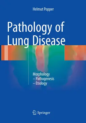 Popper |  Pathology of Lung Disease | Buch |  Sack Fachmedien