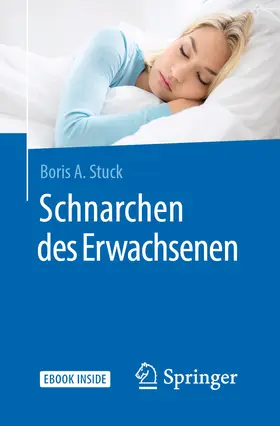 Stuck |  Anteil EPB | eBook | Sack Fachmedien