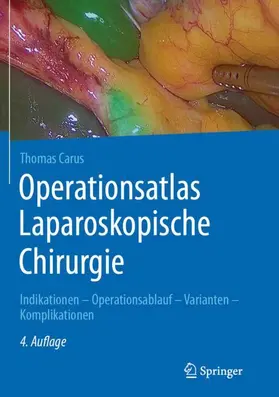 Carus |  Operationsatlas Laparoskopische Chirurgie | Buch |  Sack Fachmedien