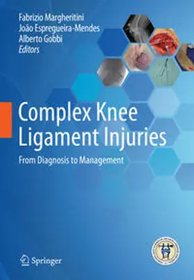 Margheritini / Gobbi / Espregueira-Mendes |  Complex Knee Ligament Injuries | Buch |  Sack Fachmedien