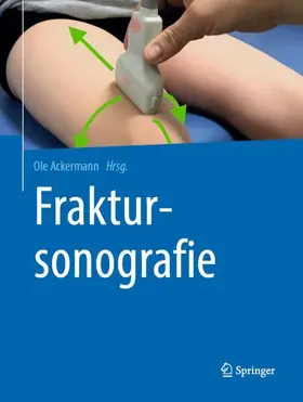 Ackermann |  Fraktursonografie | Buch |  Sack Fachmedien