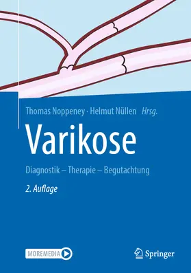 Noppeney / Nüllen |  Varikose | Buch |  Sack Fachmedien