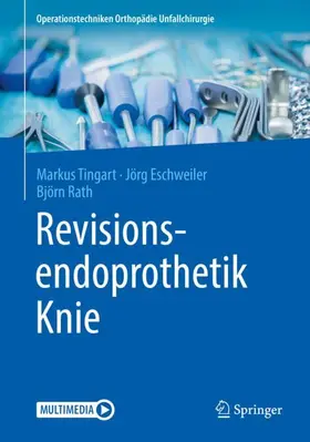 Tingart / Rath / Eschweiler |  Revisionsendoprothetik Knie | Buch |  Sack Fachmedien