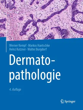 Kempf / Hantschke / Kutzner |  Dermatopathologie | Buch |  Sack Fachmedien