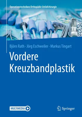 Rath / Tingart / Eschweiler |  Vordere Kreuzbandplastik | Buch |  Sack Fachmedien