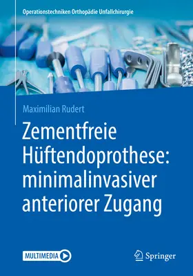Rudert |  Zementfreie Hüftendoprothese: minimalinvasiver anteriorer Zugang | eBook | Sack Fachmedien